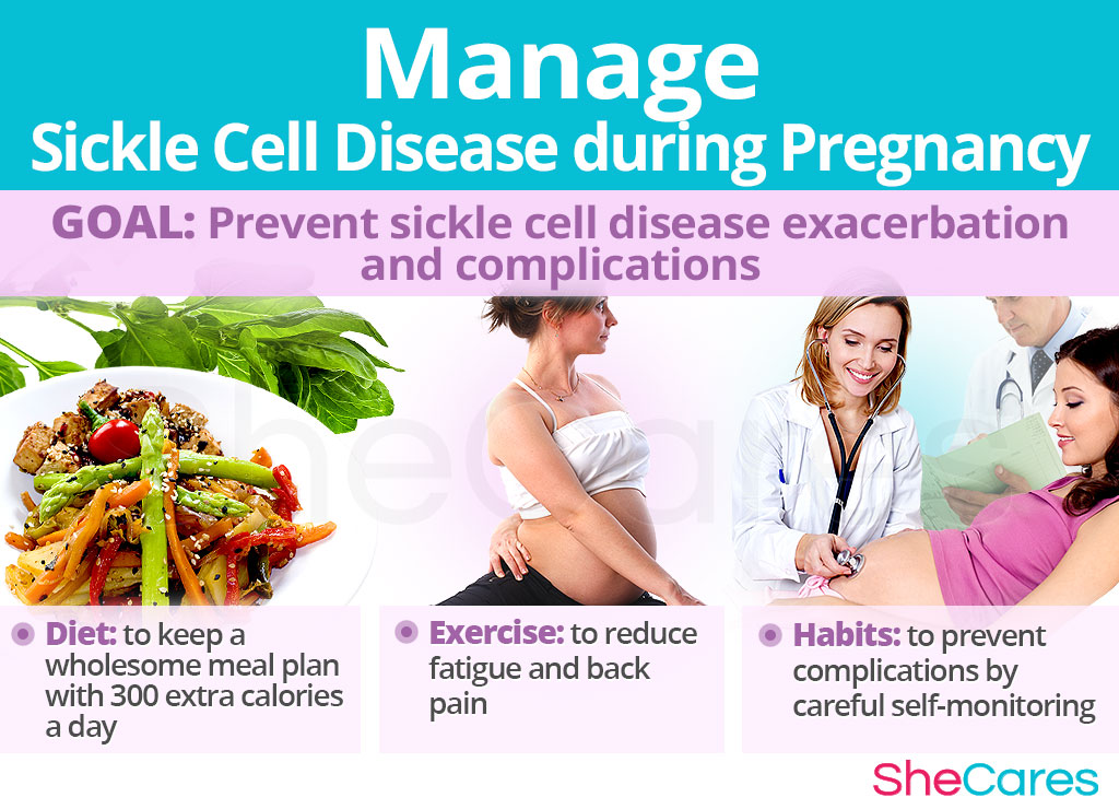 Manage Sickle Cell Disease during Pregnancy