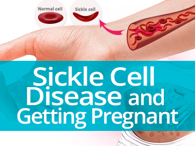 Sickle Cell Disease and Getting Pregnant