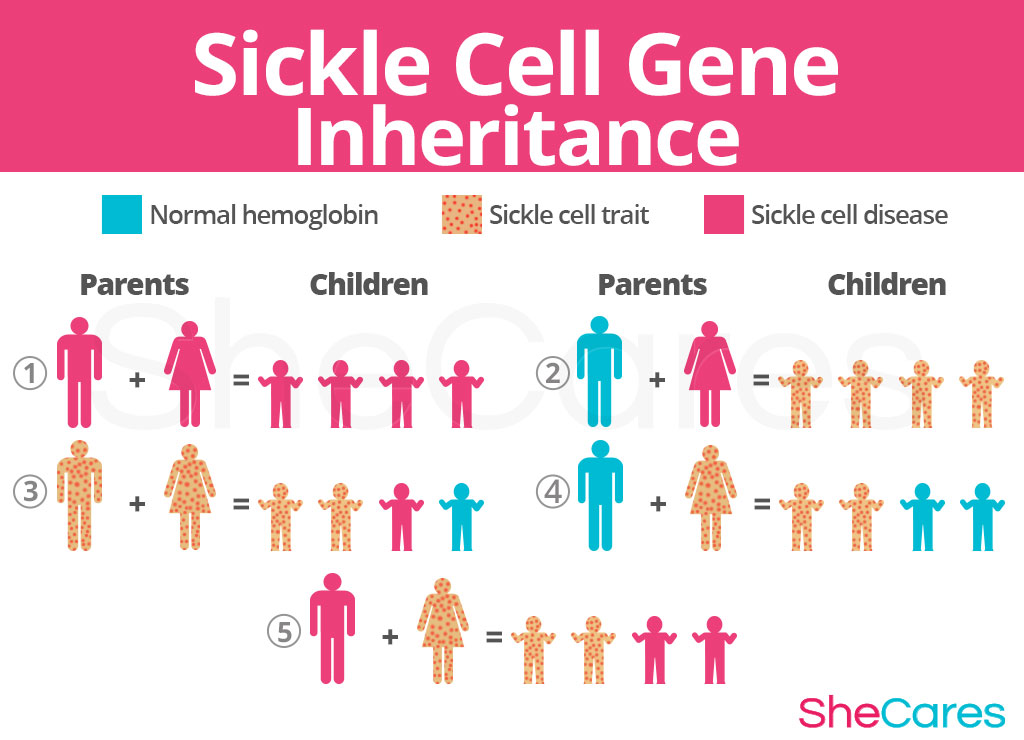 Sickle Cell Gene Inheritance