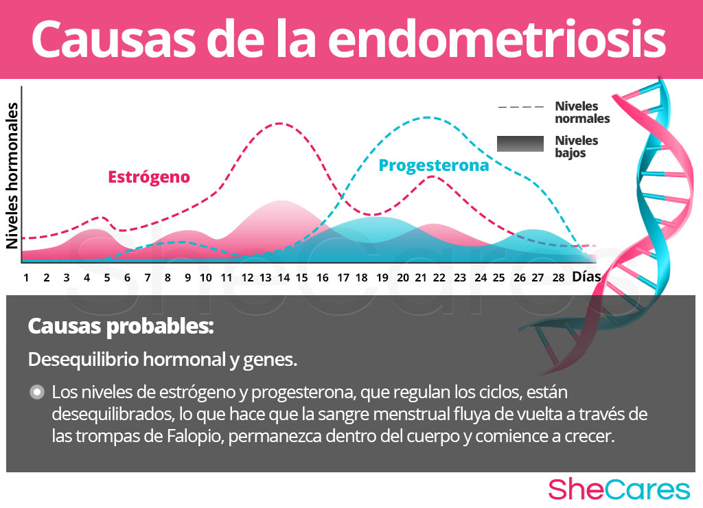 Causas de la endometriosis