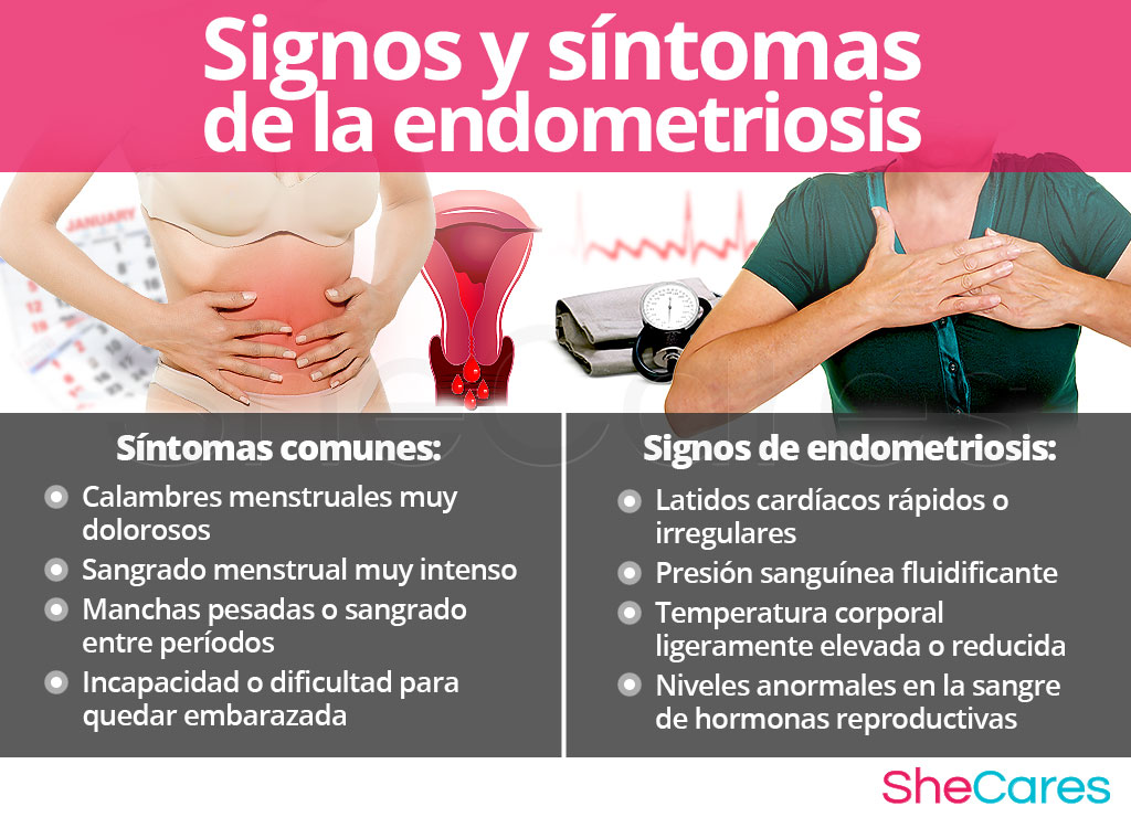 Signos y sintomas de la endometriosis