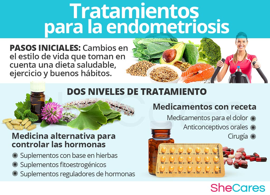 Tratamientos para la endometriosis