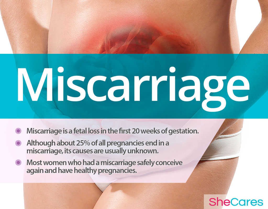 Miscarriage