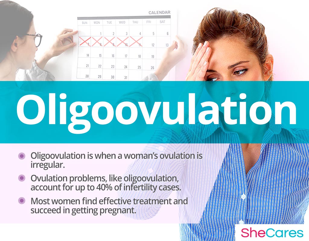 Irregular ovulation
