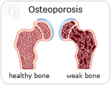 Testosterone is responsible for bone mass