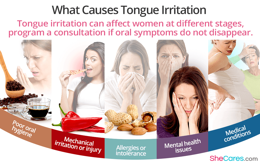 Tongue Irritation FAQs