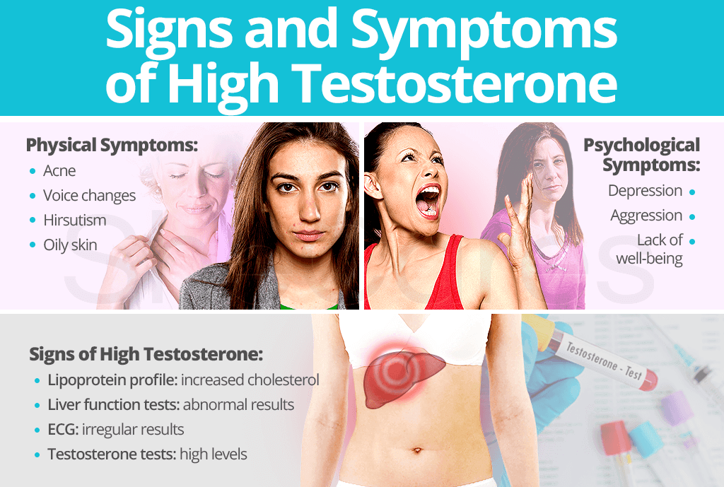 Signs and symptoms of high testosterone