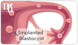 Implantation in the uterus