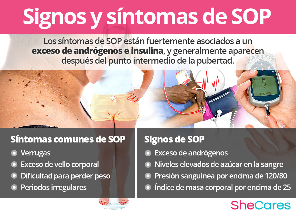 Signos y síntomas de SOP