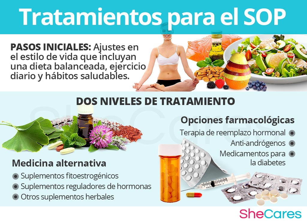 Tratamientos para el SOP