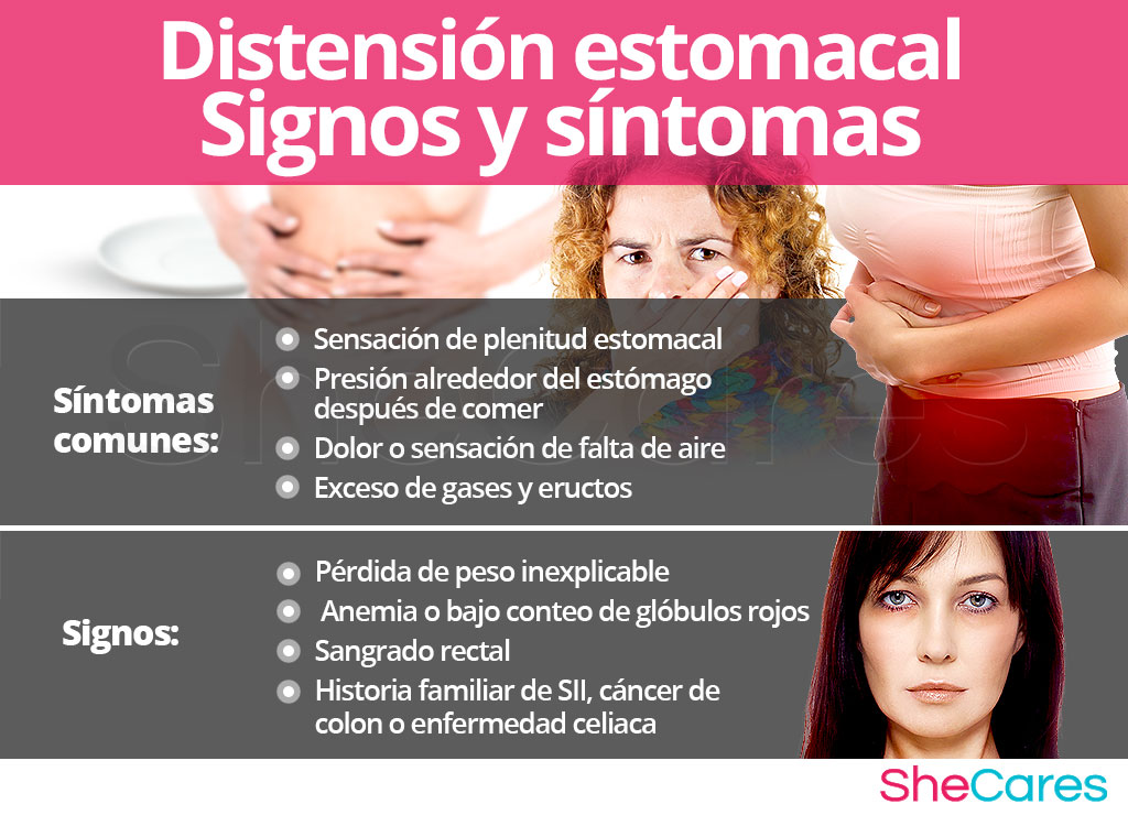 Distensión estomacal - Signos y síntomas