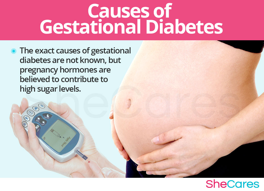 Gestational Diabetes Causes