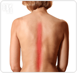 Osteoporosis is a physiological symptom of increased hormones levels