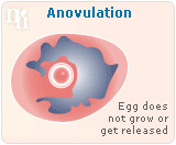 Anovulation