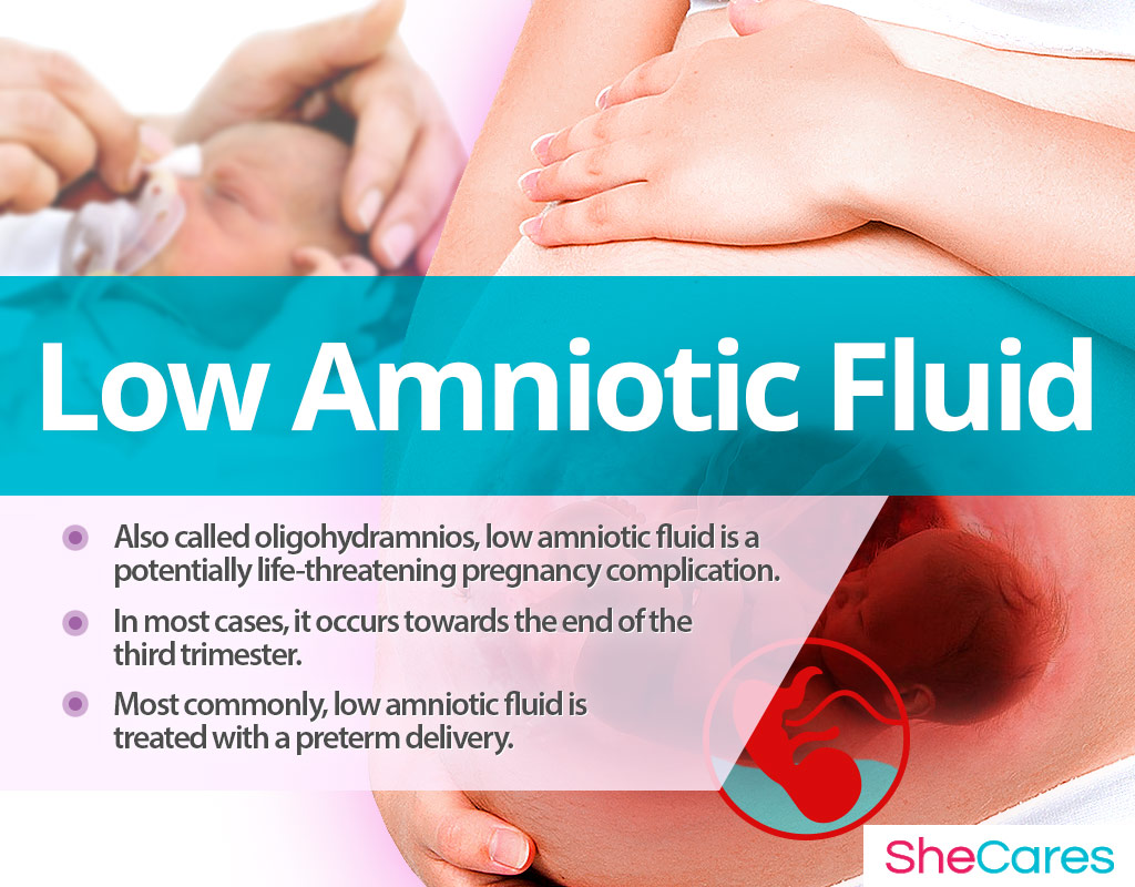 breech presentation low amniotic fluid