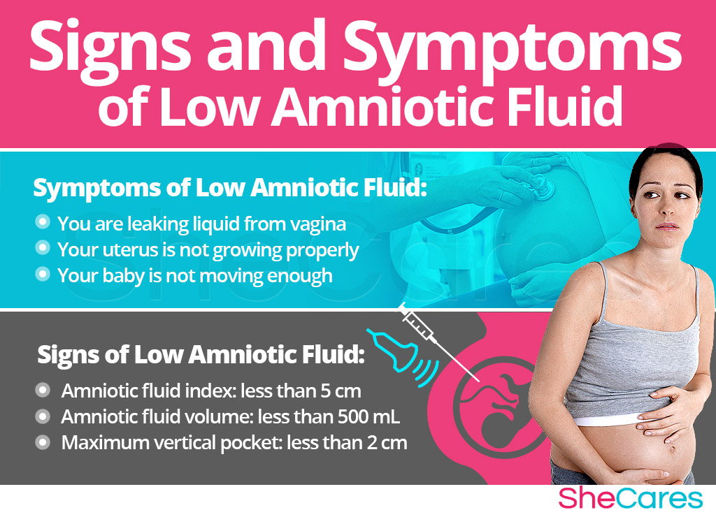 Signs and Symptoms of Low Amniotic Fluid