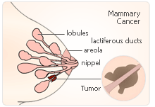 progesterone mammary cancer